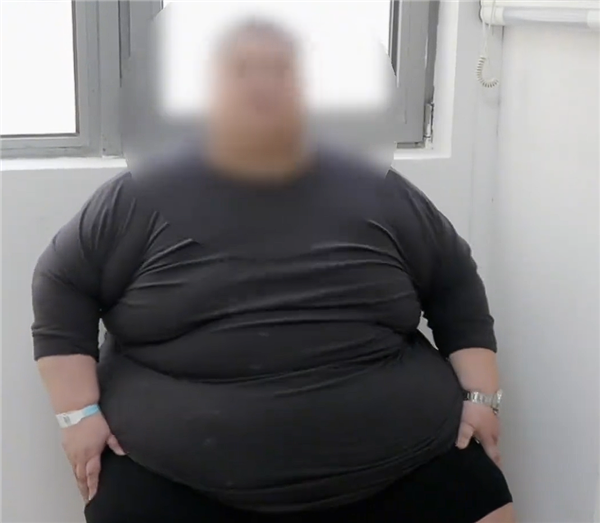 运动员退役后从146斤暴涨至523斤 手术切除75%胃组织