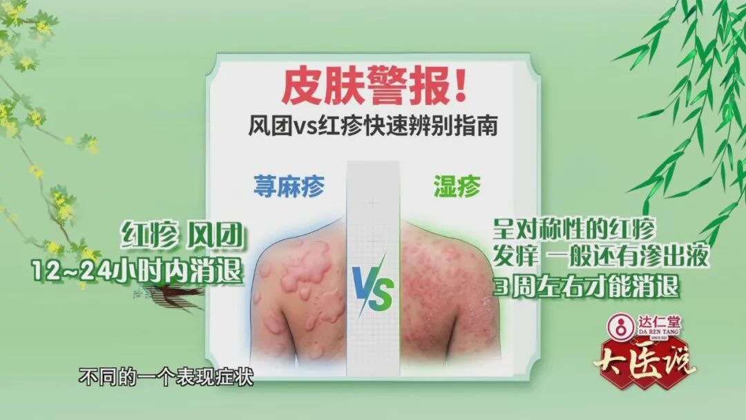 达仁堂邀您关注大医说|春日过敏季内外调养护肌肤_新浪财经_新浪网