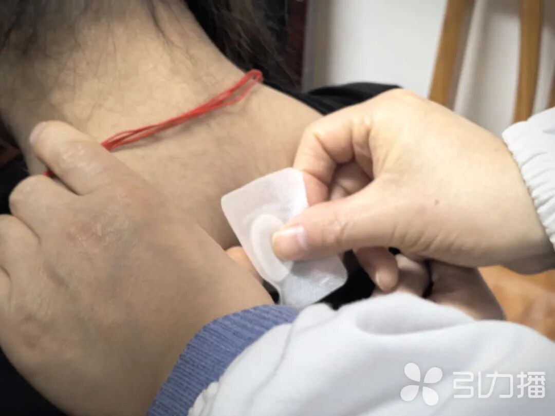 中医师为儿童贴“生长贴”