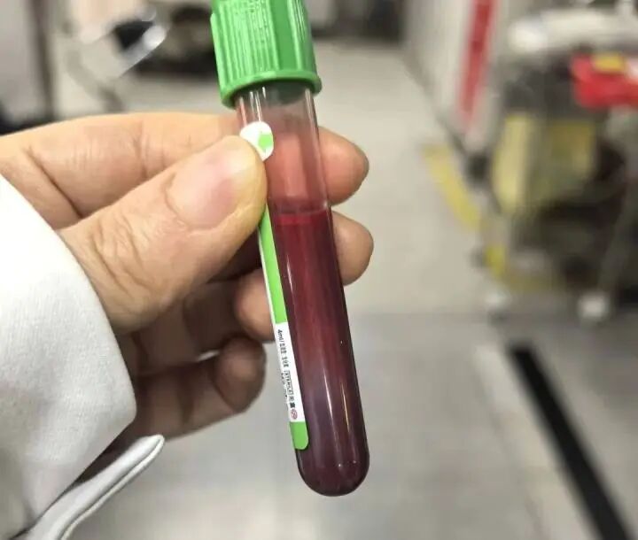 “快生了吃点好的没关系”，孕妇狂吃炸鸡汉堡，一周胖10斤，抽出“草莓牛奶”血，母婴双双进ICU