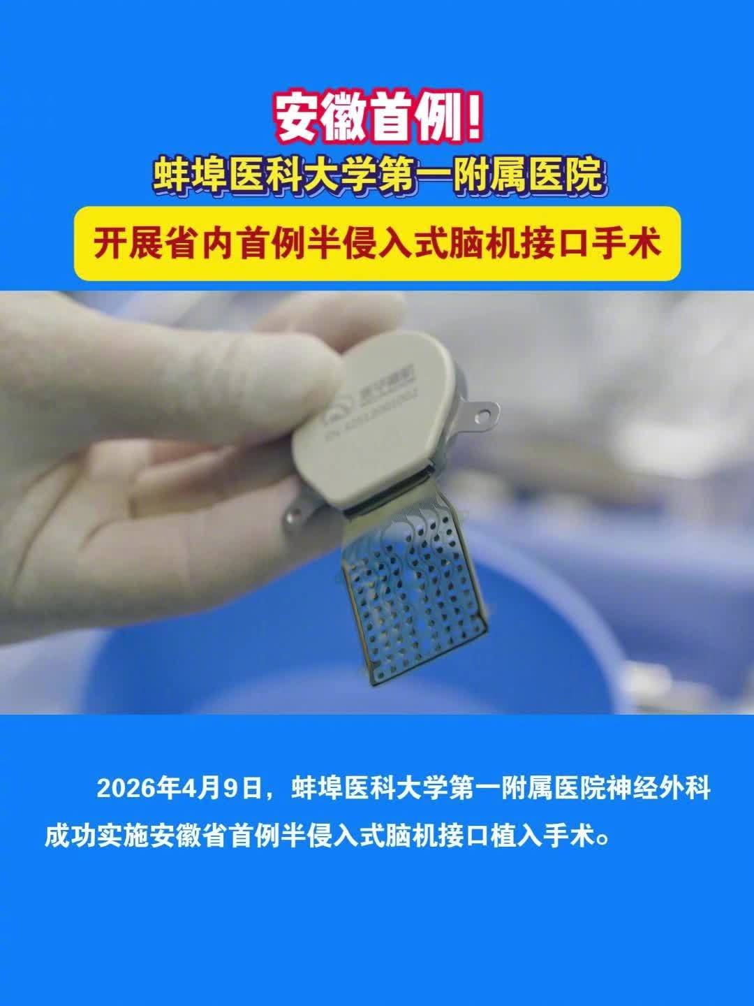 安徽省首例半侵入式脑机接口植入手术成功，患者有望重获抓、握、捏等左手精准运动功能
