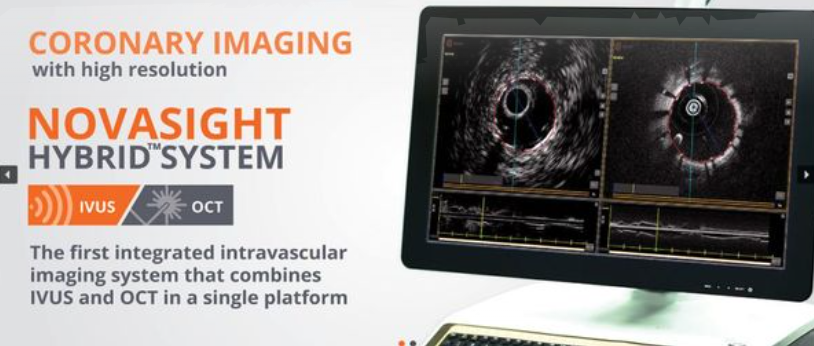 IVUS-OCT一体机FDA获批,双模成像时代来了|微米_新浪财经_新浪网
