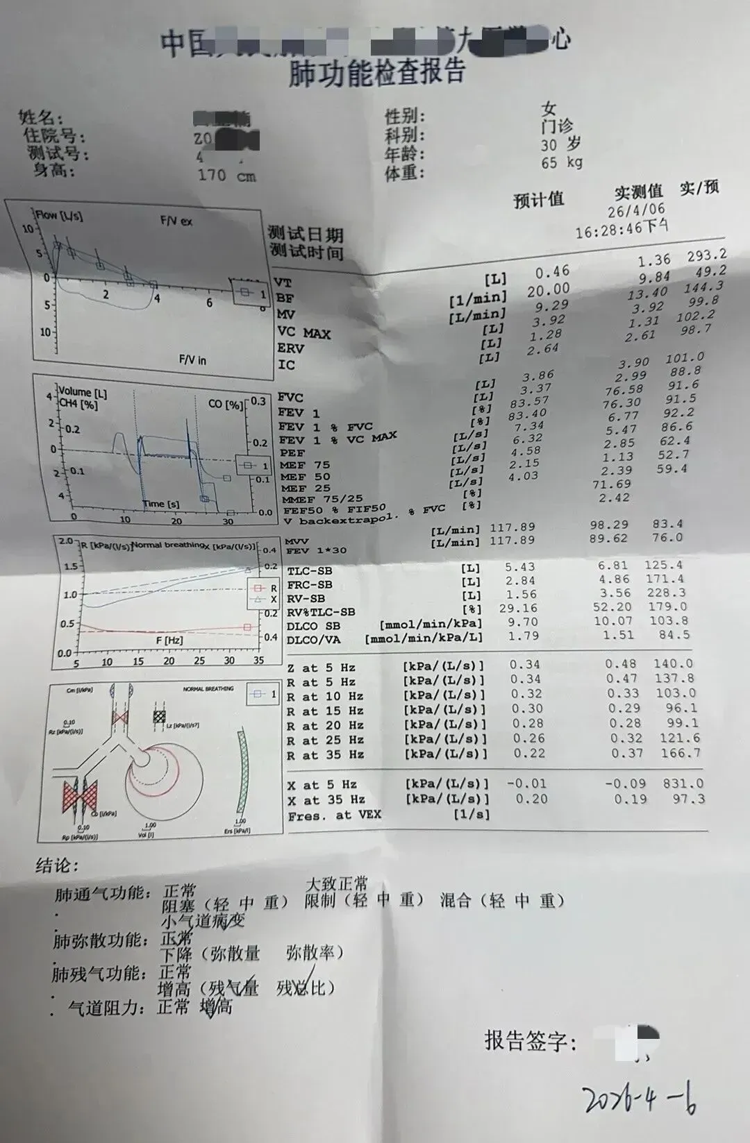 △张女士做的肺功能测试图片 