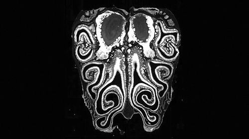 图片来源：Datta Lab