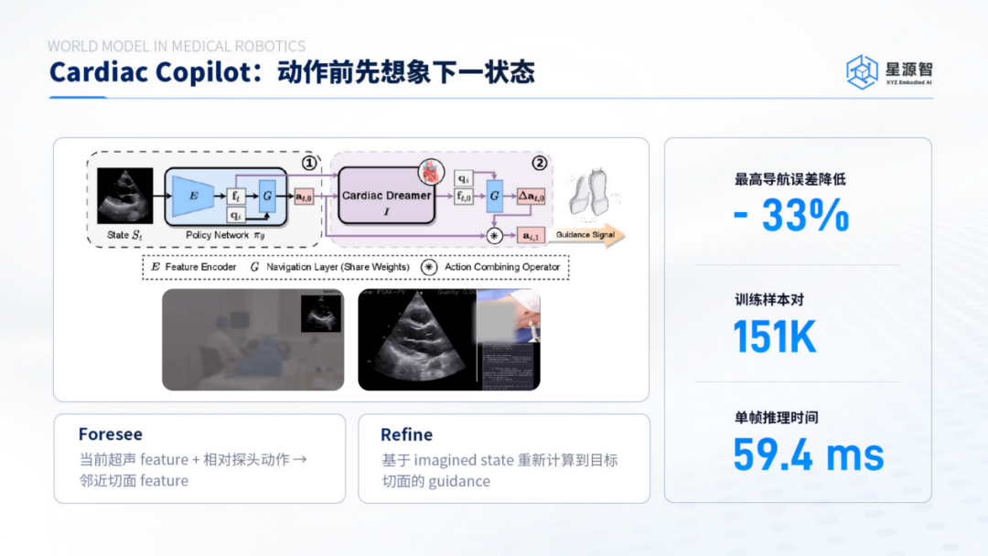 心脏超声导航项目Cardiac Copilot示意（图片来源：星源智）