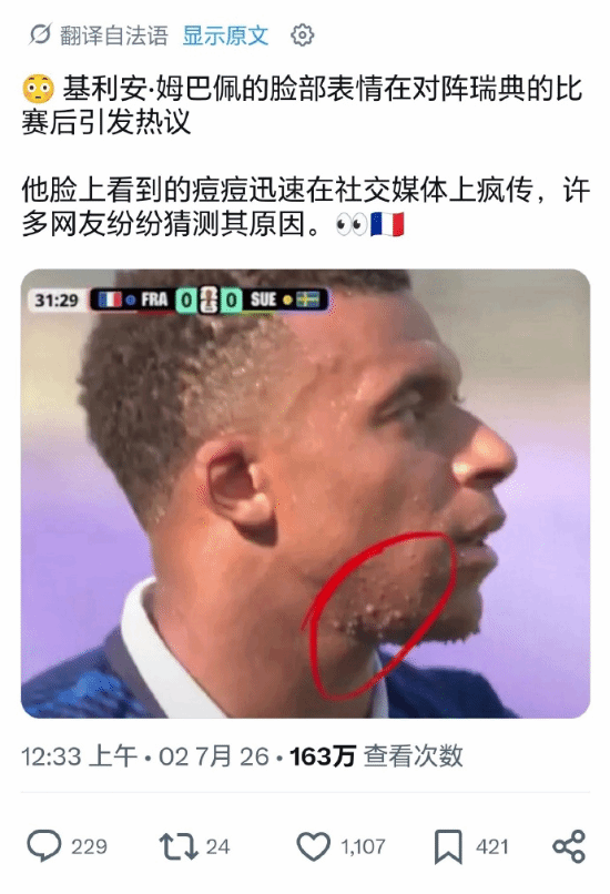 巴拉圭对阵法国jrs视频高清直播_巴拉圭对阵法国综合直播_巴拉圭对阵法国比赛高清全程直播