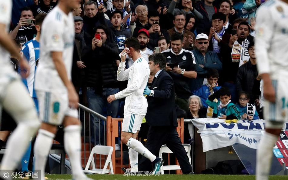 硬汉！C罗眉骨被踢破 一脸血