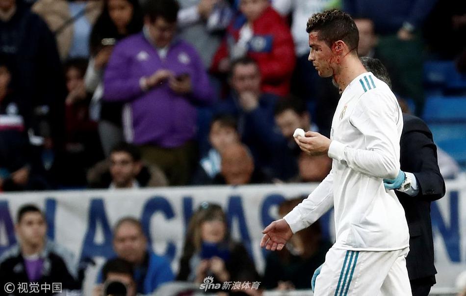 硬汉！C罗眉骨被踢破 一脸血