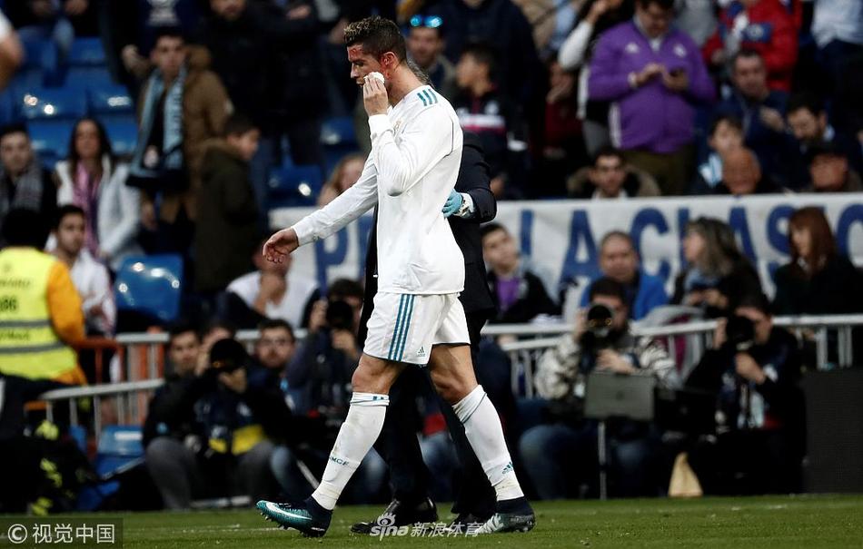 硬汉！C罗眉骨被踢破 一脸血