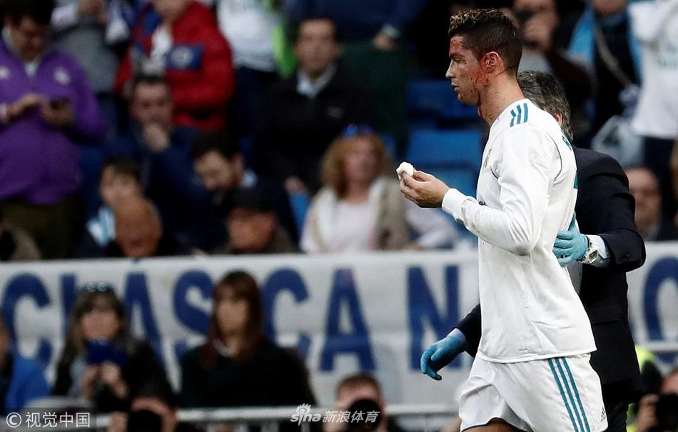 硬汉！C罗眉骨被踢破 一脸血