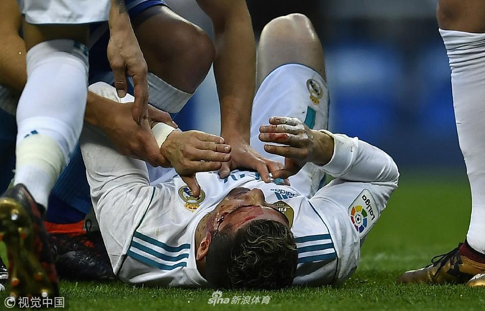 硬汉！C罗眉骨被踢破 一脸血