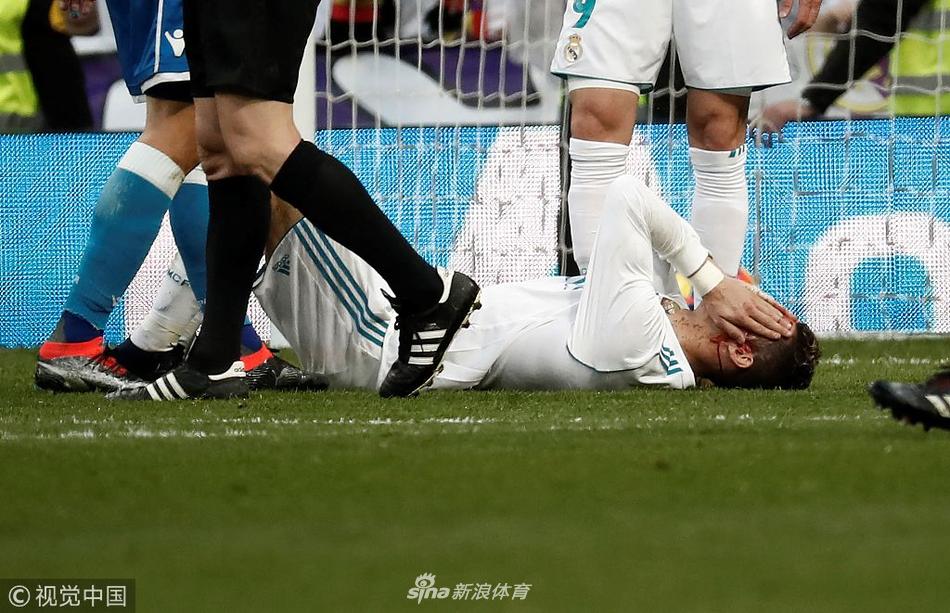 硬汉！C罗眉骨被踢破 一脸血