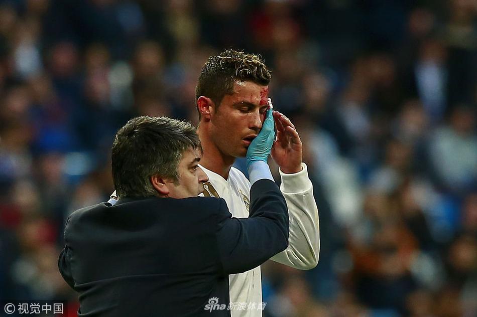 硬汉！C罗眉骨被踢破 一脸血