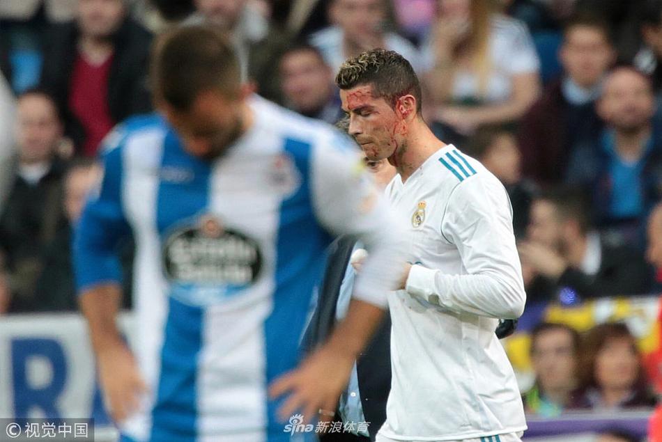 硬汉！C罗眉骨被踢破 一脸血