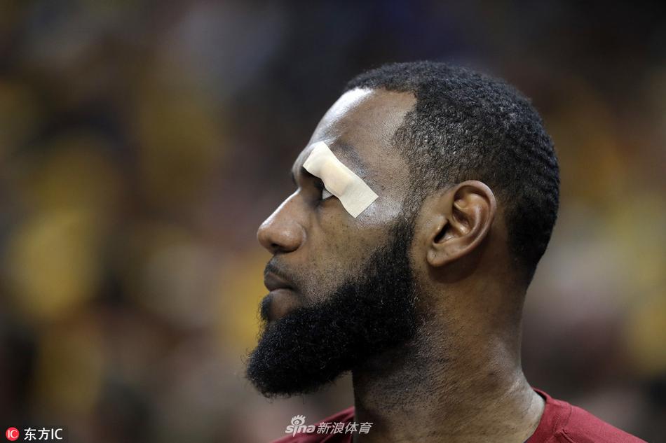 特写!詹皇眉骨被打破血流不止