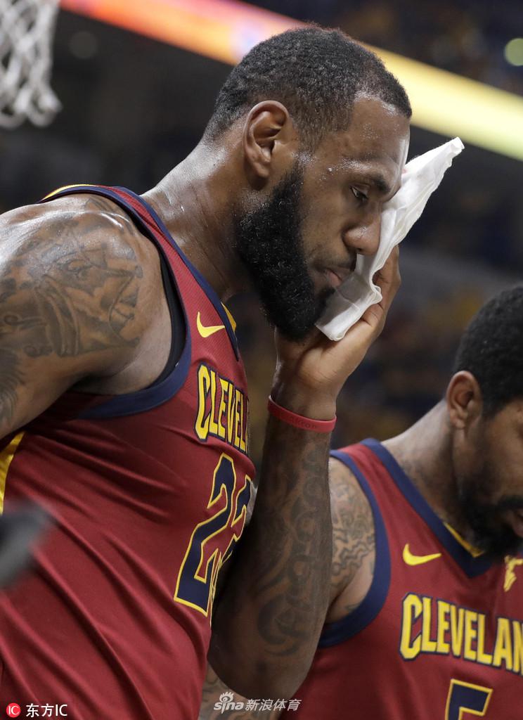 詹姆斯眉骨挂彩