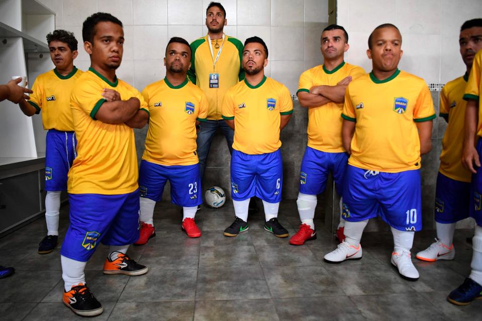 震撼！侏儒症患者足球大赛举行 梅西支持