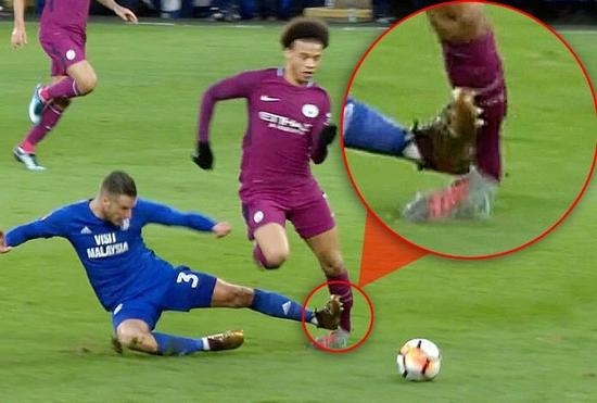 惊了！曼城大将脚踝被铲成L形
