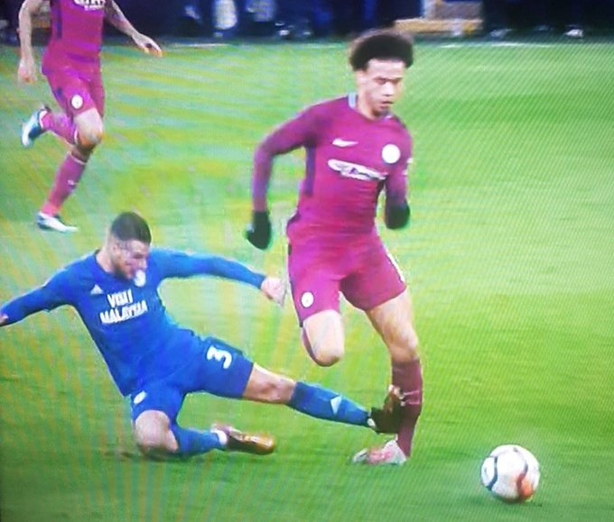 惊了！曼城大将脚踝被铲成L形