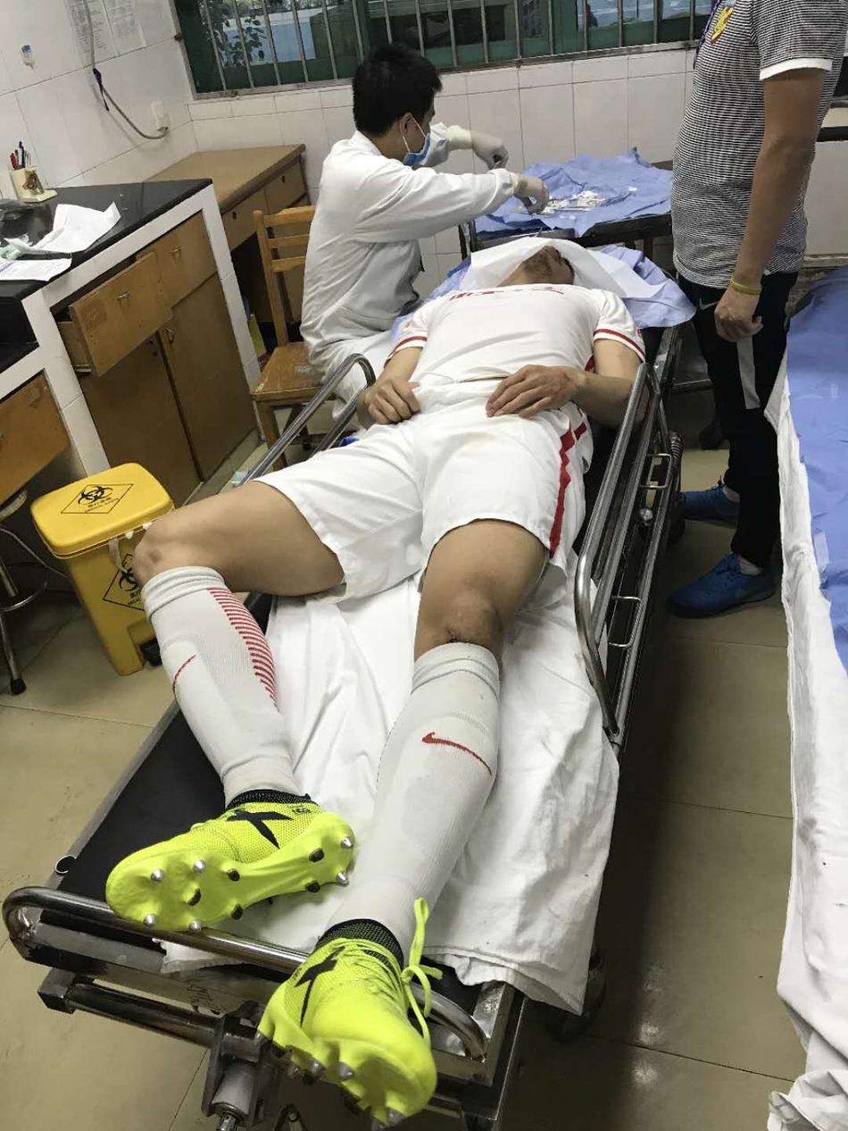 权健为了这场胜利也是拼了,恒大主力后腰赵旭日在比赛中拼得眉骨受伤