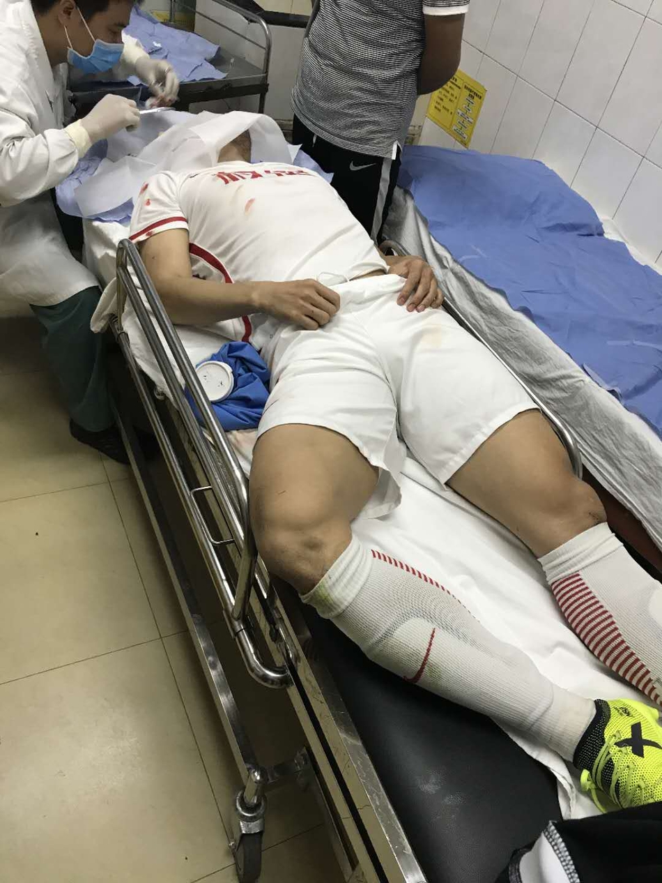 权健为了这场胜利也是拼了,恒大主力后腰赵旭日在比赛中拼得眉骨受伤