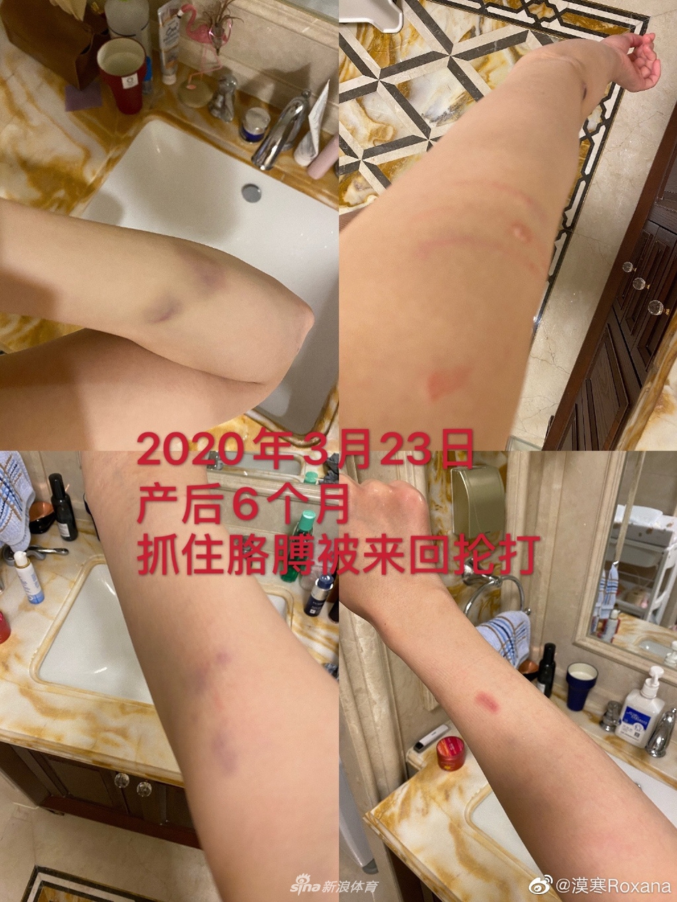 张培萌妻子晒遭家暴证据