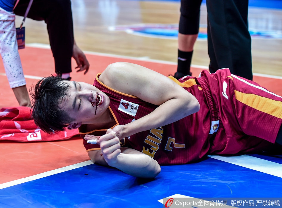 慎点！19岁小将遭肘击嘴唇爆裂