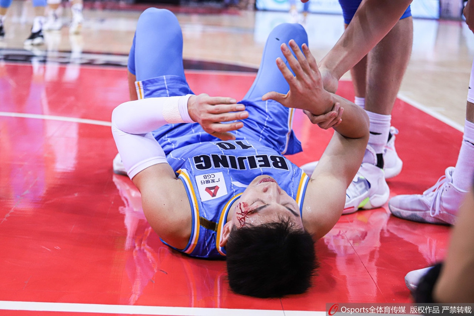 刘晓宇眉骨摔裂血流满面