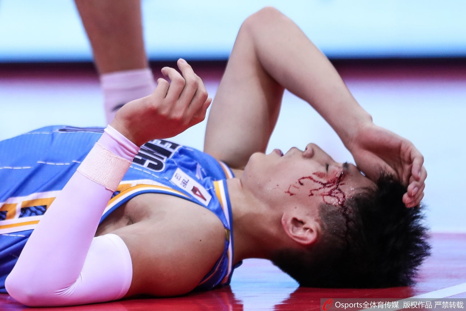 刘晓宇眉骨摔裂血流满面