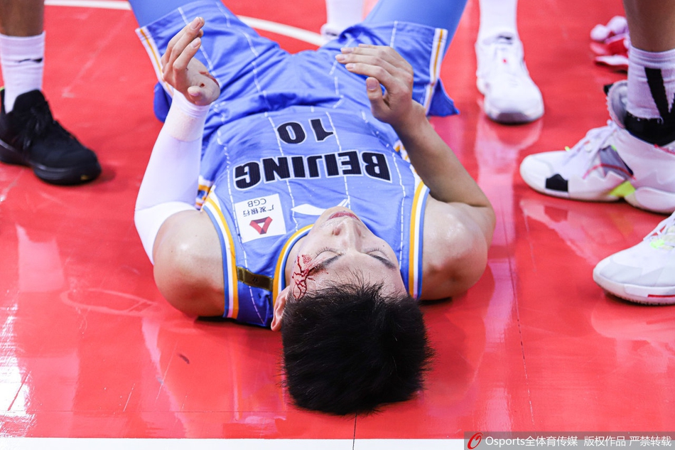 刘晓宇眉骨摔裂血流满面