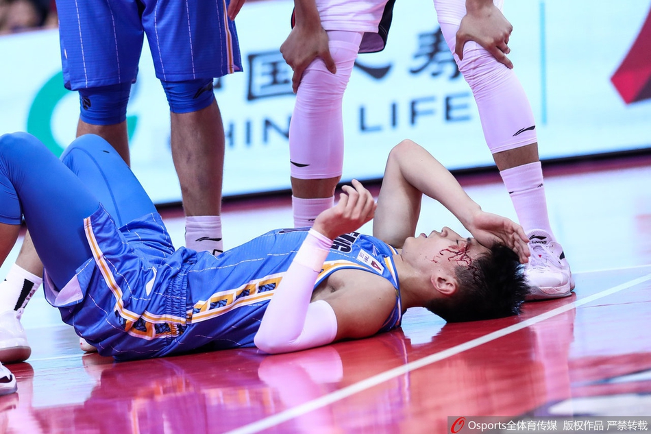 刘晓宇眉骨摔裂血流满面