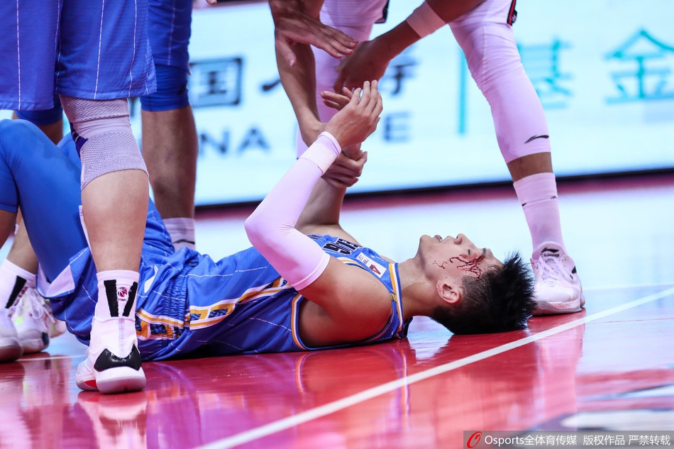 刘晓宇眉骨摔裂血流满面