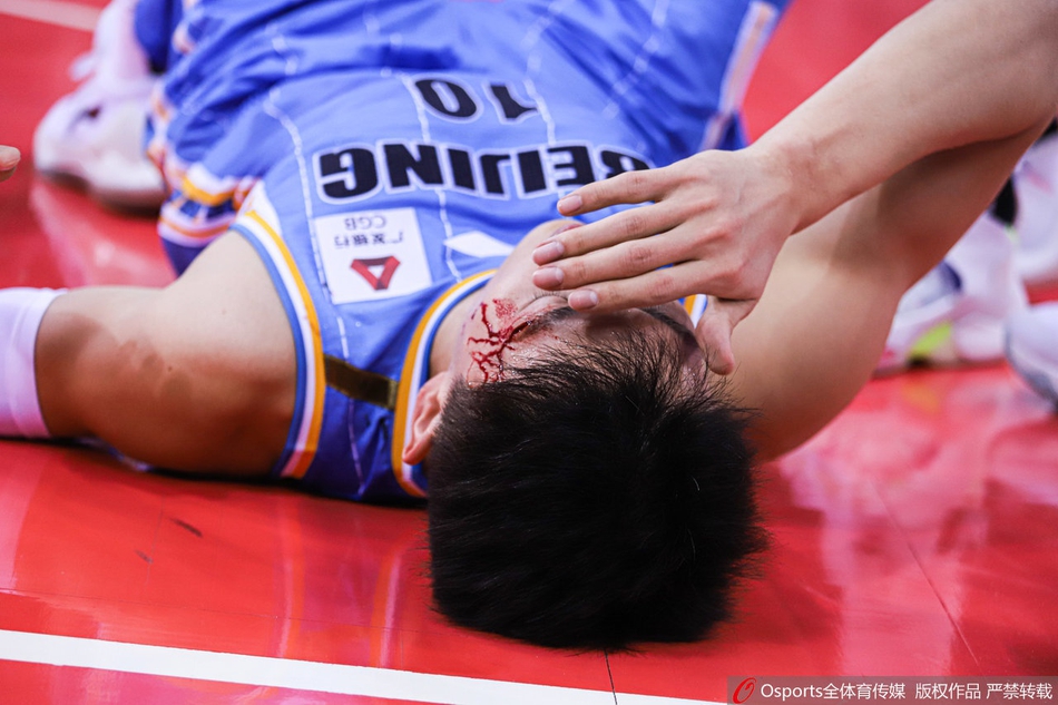 刘晓宇眉骨摔裂血流满面