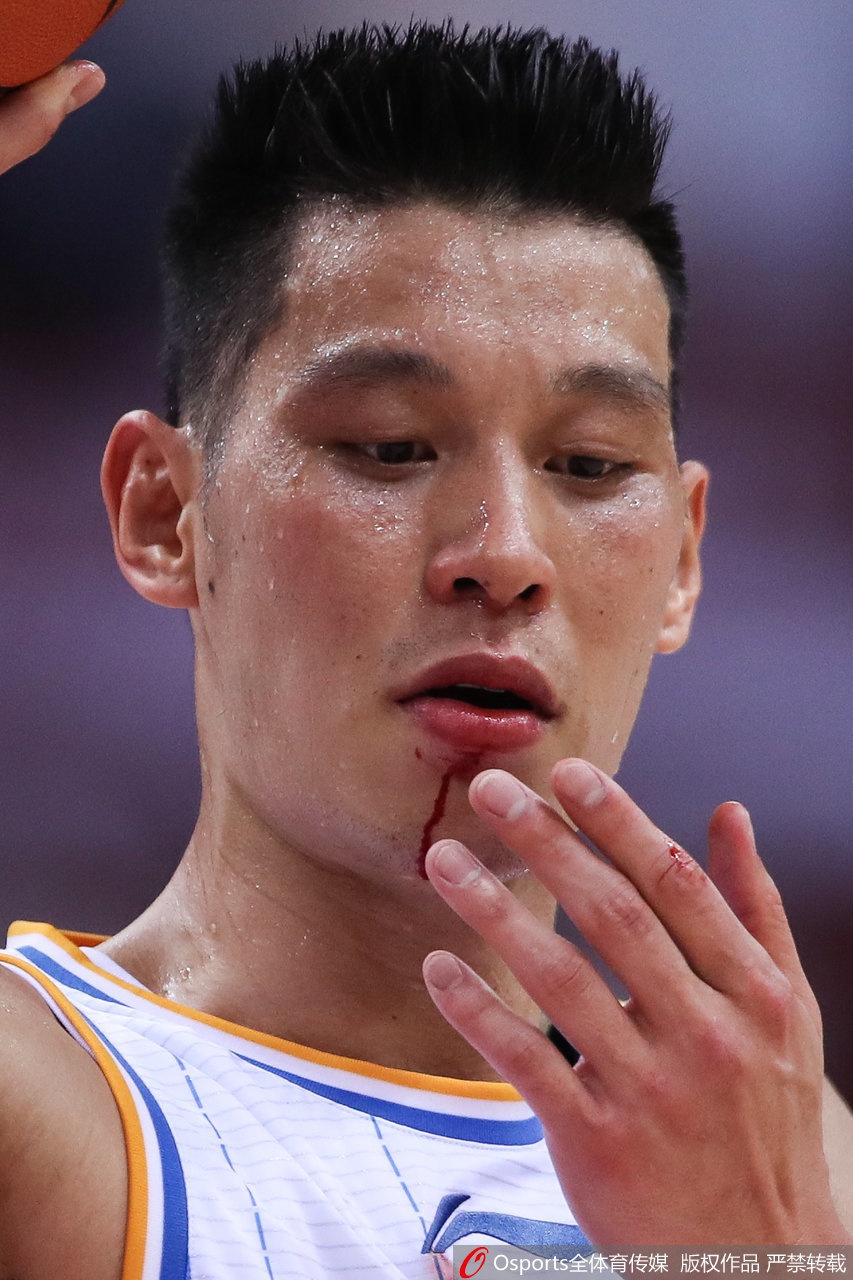 林书豪嘴角被撞出血