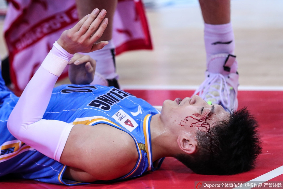 刘晓宇眉骨摔裂血流满面