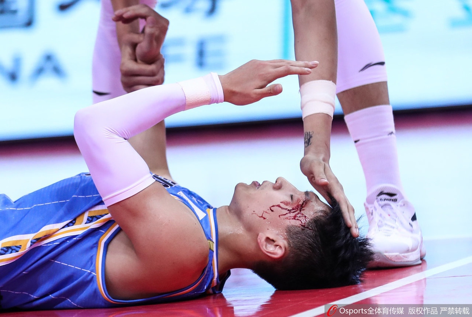 刘晓宇眉骨摔裂血流满面