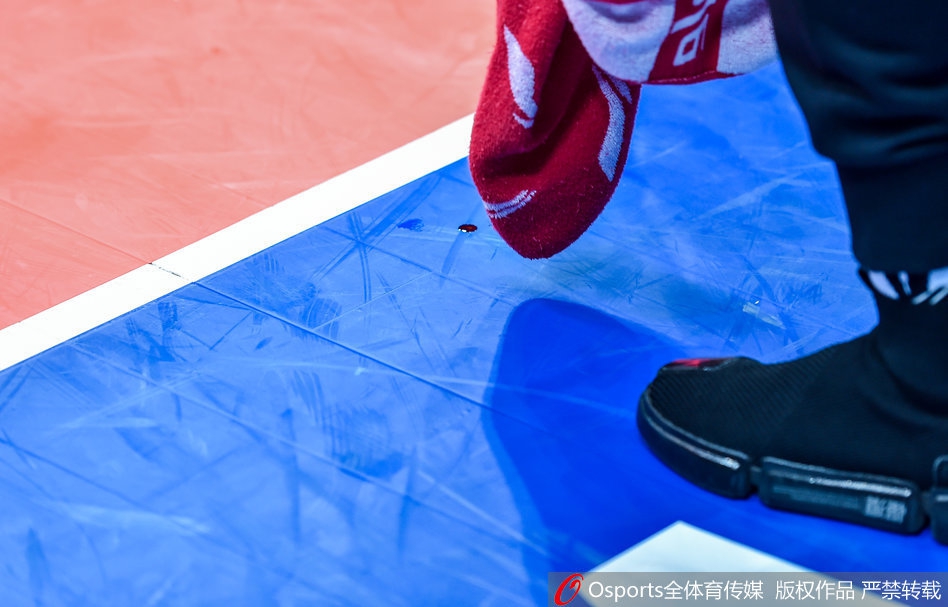 慎点！19岁小将遭肘击嘴唇爆裂