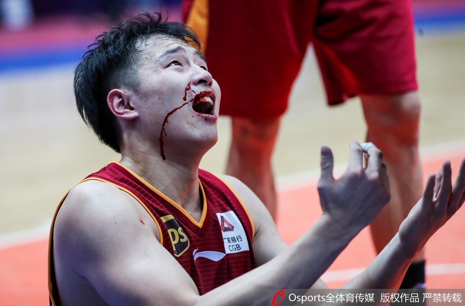 慎点！19岁小将遭肘击嘴唇爆裂