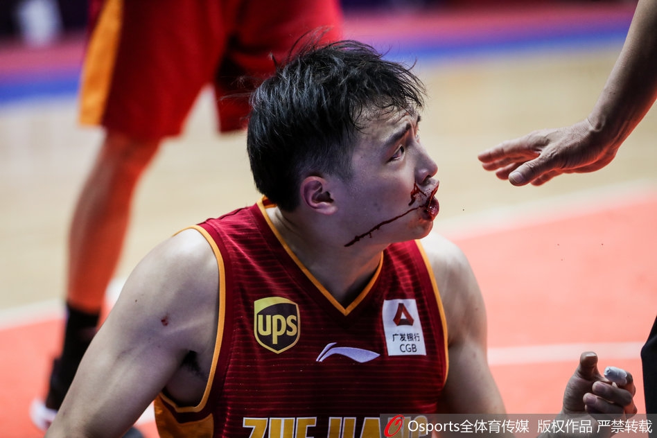 慎点！19岁小将遭肘击嘴唇爆裂