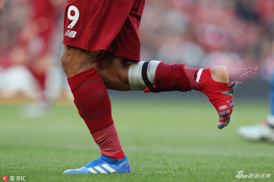 菲米袜子被踩破