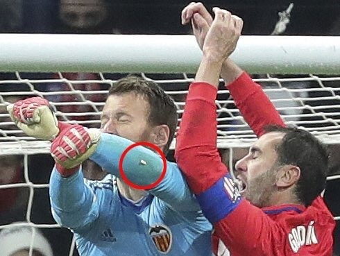 飞出的牙齿清晰可见