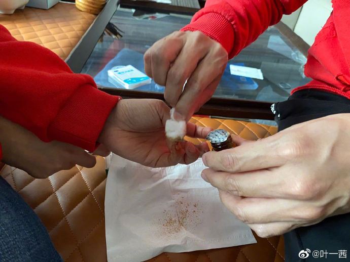 田亮给老婆贴创口贴 叶一茜笑称细致得像路边贴膜的