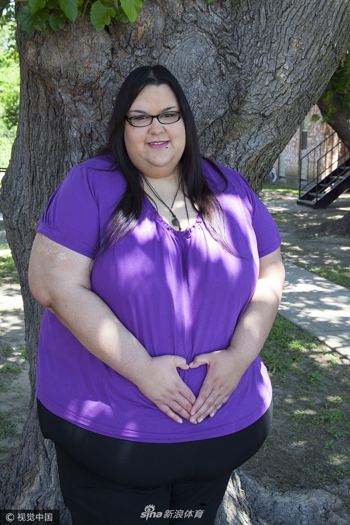 美国600斤女子减182斤备孕 曾用漏斗喂食