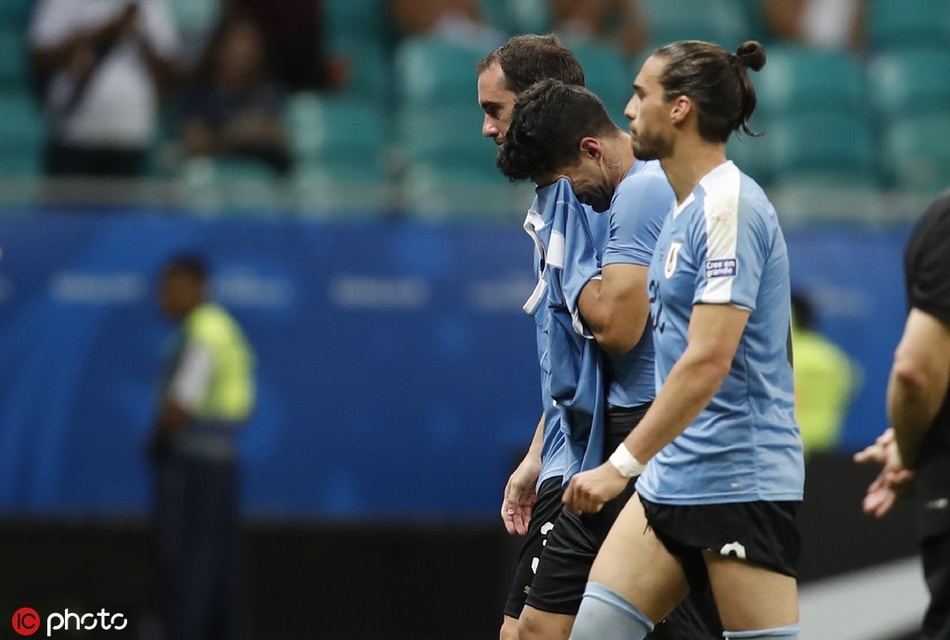 苏牙罚失点球 出局后掩面痛哭