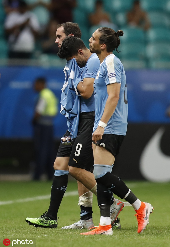 苏牙罚失点球 出局后掩面痛哭