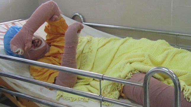 伊朗女子看球被捕 自焚抗议女性禁令