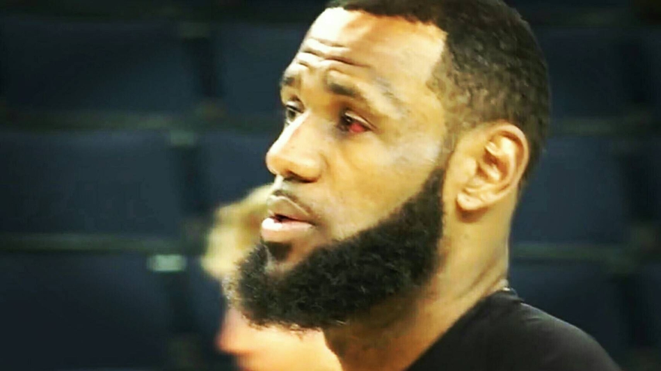 詹姆斯备战G2 左眼血块明显