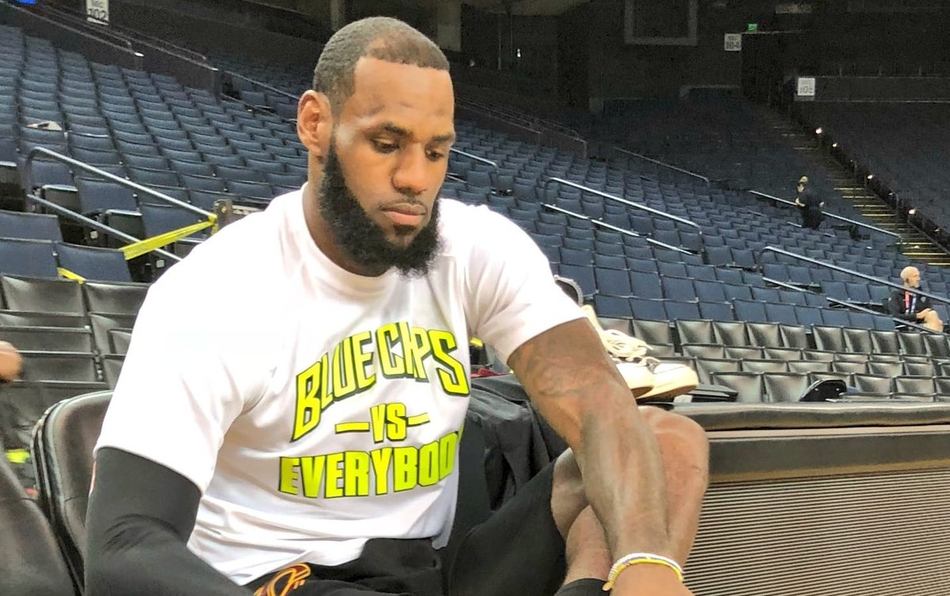 詹姆斯左眼血块明显