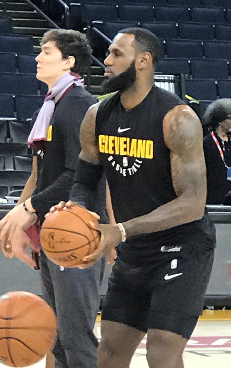 詹姆斯左眼血块明显