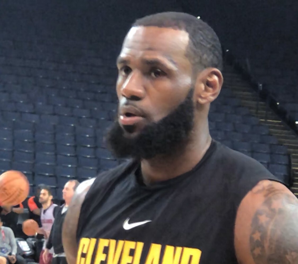 詹姆斯左眼血块明显